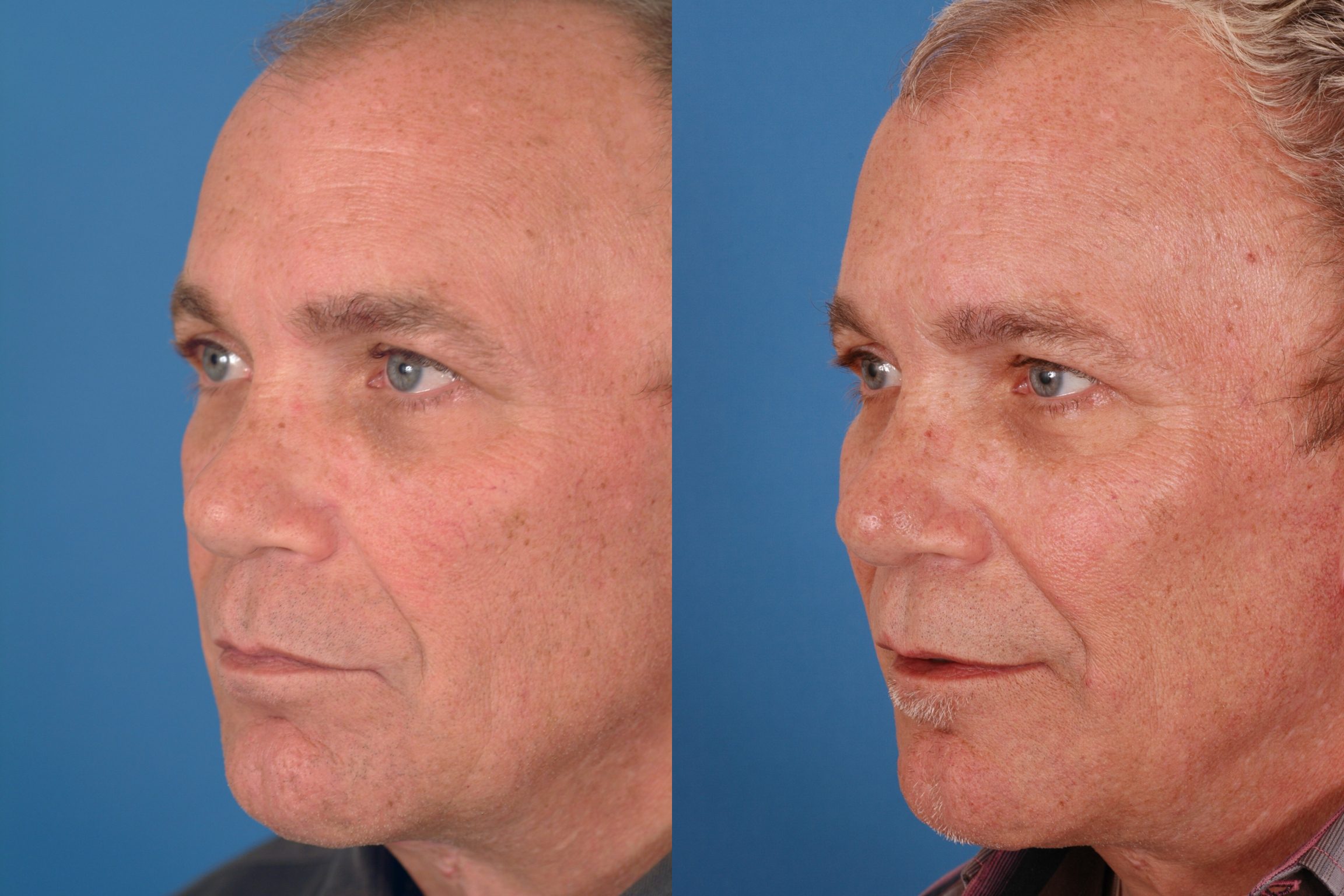 Advanced Facial Plastic Surgery 81