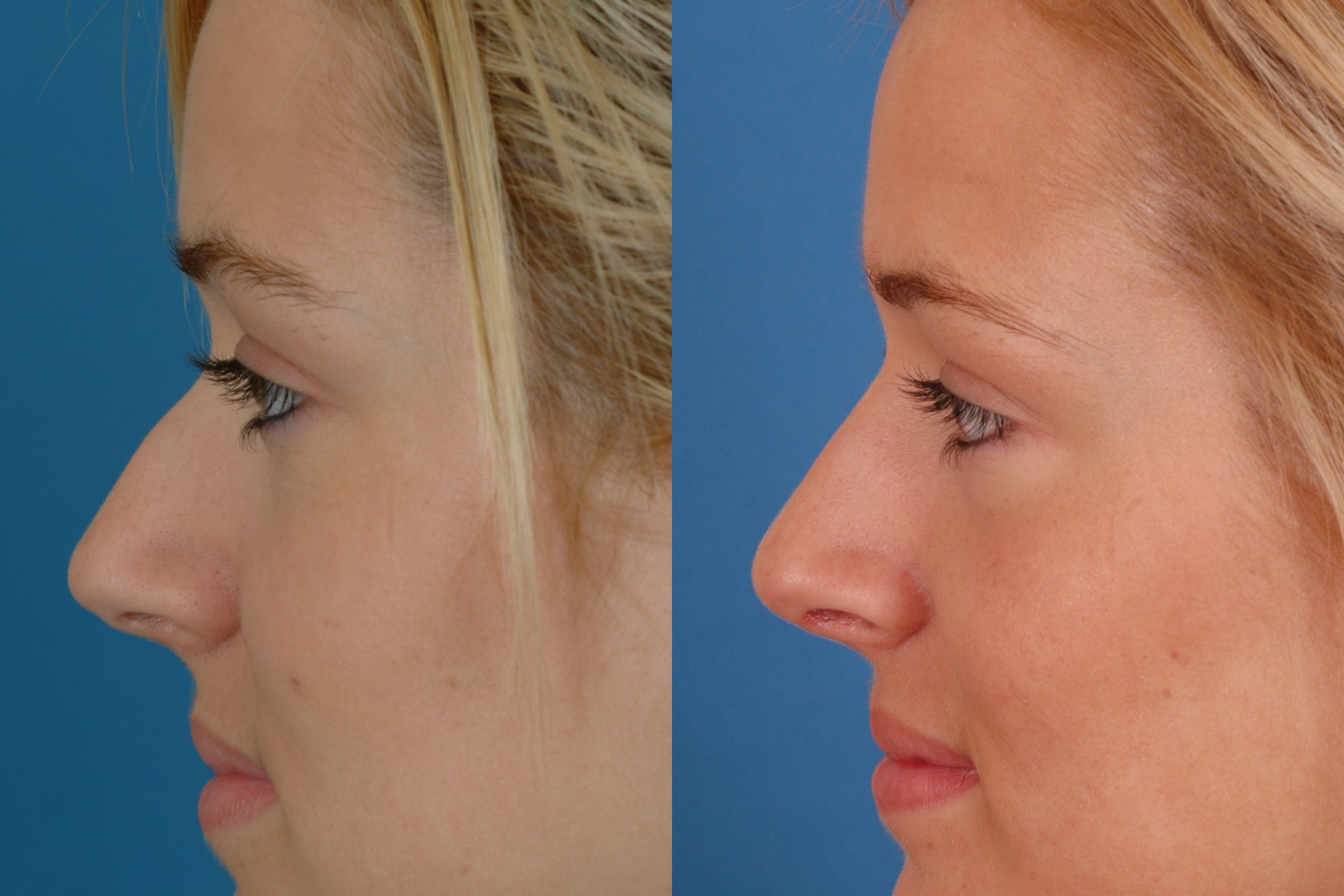Advanced Facial Plastic Surgery 53