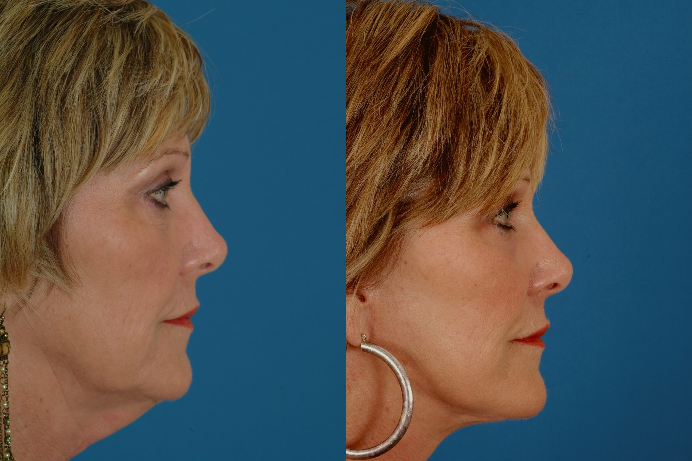 Advanced Facial Plastic Surgery 31