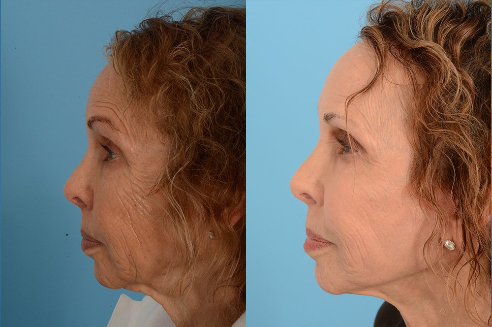 Advanced Facial Plastic Surgery Center 17