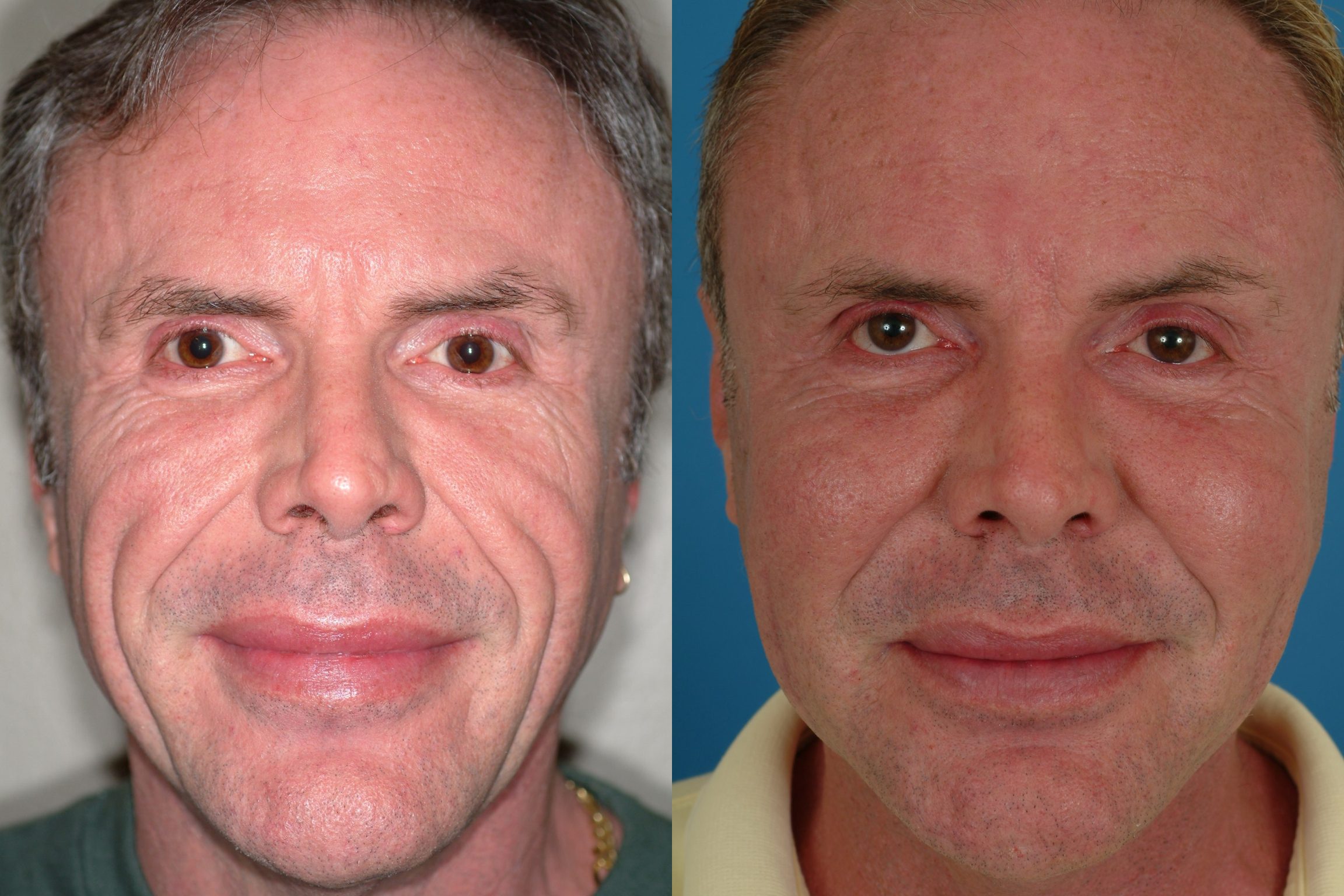 Avana plastic surgery dr scurlock