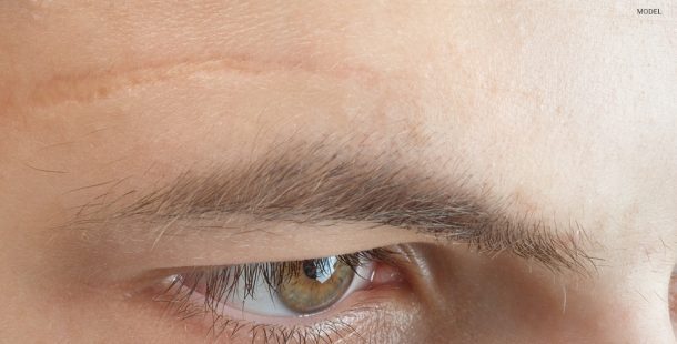 Close Up of Scar Above a Male Model's Eye